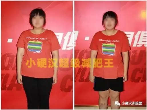 孩子肥胖怎么办-滨州青少年减肥夏令营专家来支招